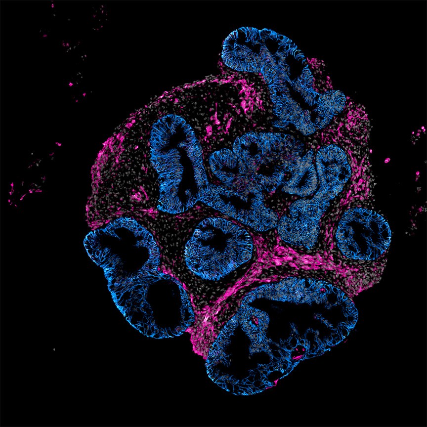 Human intestinal organoid grown by Intero Biosystems for drug testing